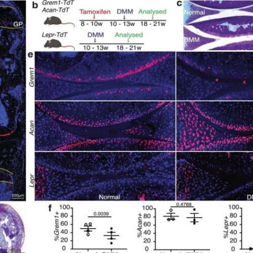 Gremlin 1 cells discovery offers hope to treat and reverse osteoarthritis