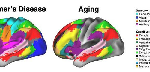 Study reveals broader impact of Alzheimer’s on brain function