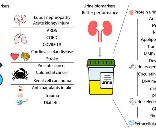 Urine biomarkers can outperform serum biomarkers in certain diseases