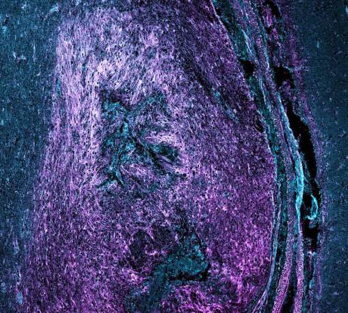 Deciphering the secrets of spinal cord regeneration protein by protein