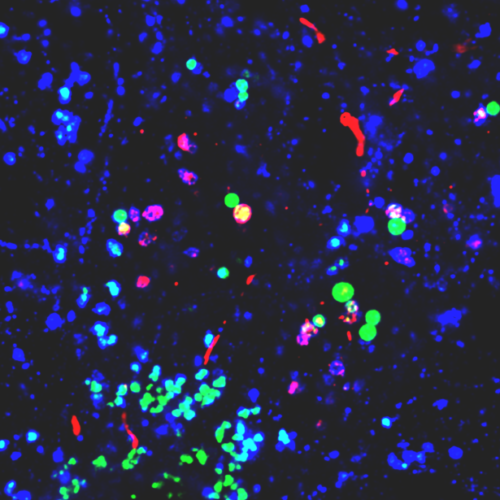 Nanoplastics Promote Conditions for Parkinson’s Across Various Lab Models