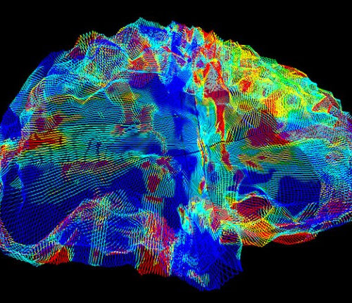 AI that reads brain scans shows promise for finding Alzheimer’s genes