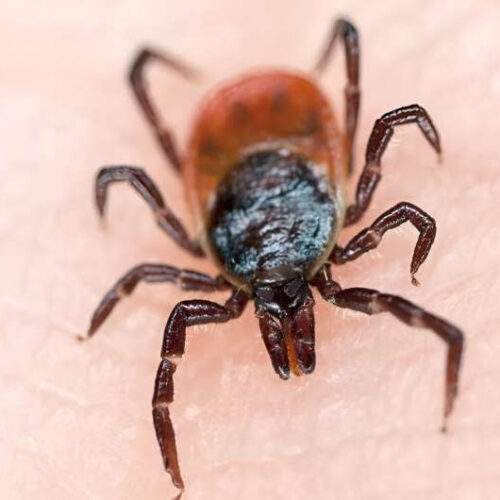 What is babesiosis, a tick-borne illness?