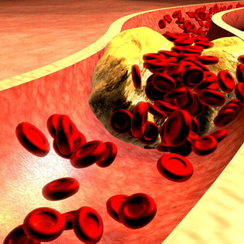 Key discovery opens new avenue to lowering cholesterol levels