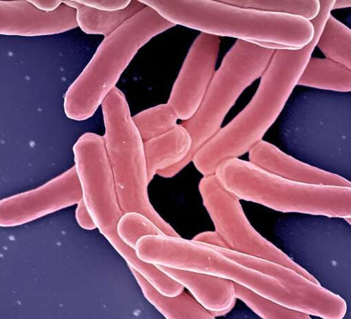 Breakthroughs hailed in childhood TB prevention