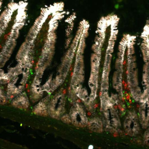 Unveiling a novel immune response in the intestinal epithelium