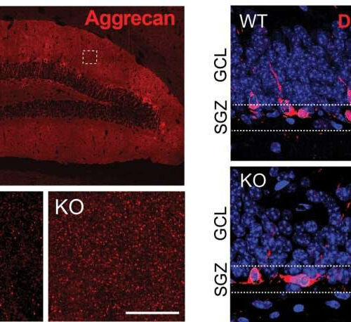 Researchers detail mechanism of a key protein implicated in age-related brain dysfunction