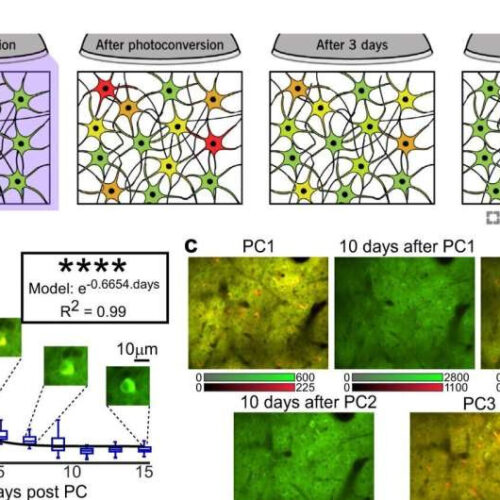 Non-invasive technology maps brain activity to investigate behavior changes in neurological disease