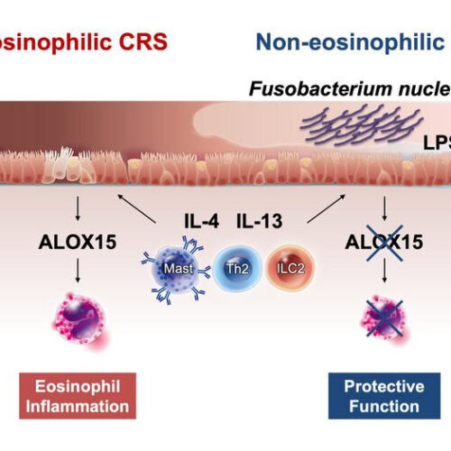 Nasal microorganism to the rescue? Study confirms protective role of bacterium in chronic rhinosinusitis