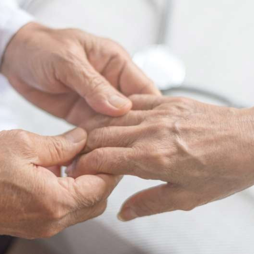 Arthritic hands: What works (and doesn’t) to ease the pain?