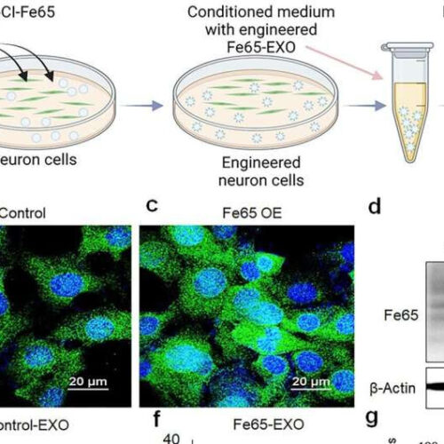 Novel drug delivery system developed for Gouteng compound for Alzheimer’s disease treatment