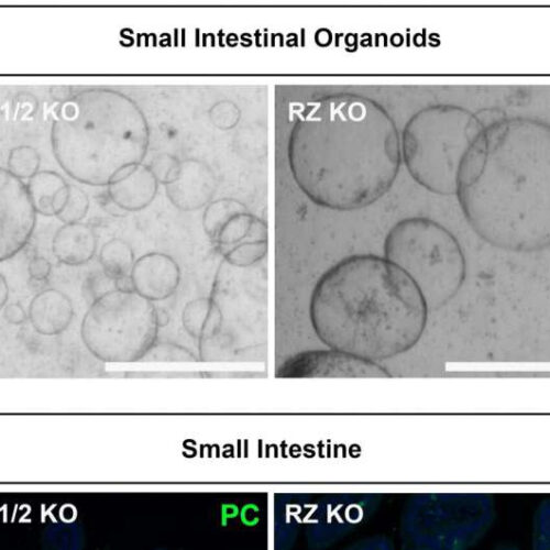 Decoding cell fate: Key mechanism in stem cell switch identified