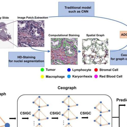 AI accurately predicts cancer outcomes from tissue samples