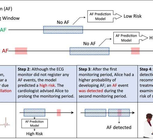 New AI-powered algorithm could better assess people’s risk of common heart condition