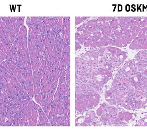 Study finds vitamin B12 is a key player in cellular reprogramming and tissue regeneration