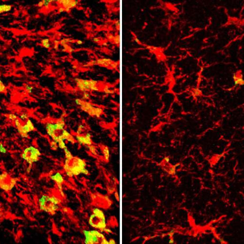 Lowering a form of brain cholesterol reduces Alzheimer’s-like damage in mice