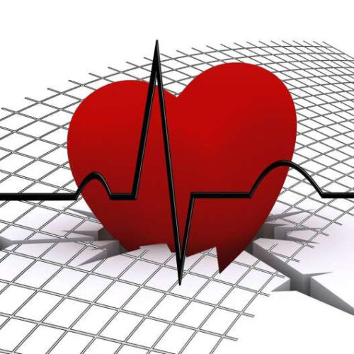 Coronary heart disease before age 45 may increase risk of dementia later in life