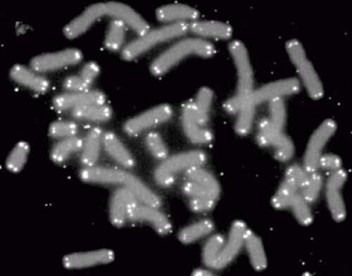 How shortened telomeres heighten risk of serious lung disease