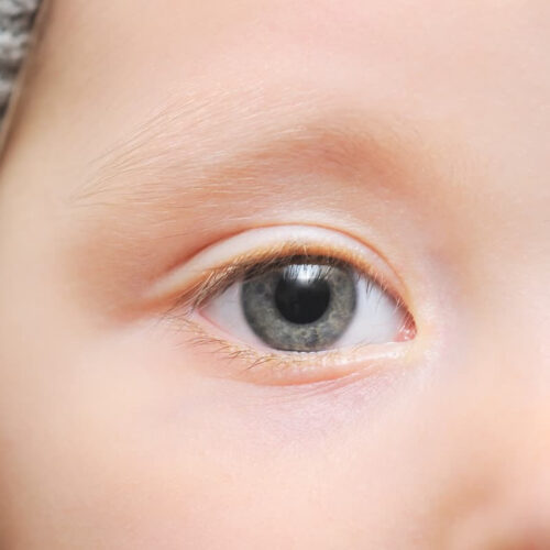 AI-screened eye pics diagnose childhood autism with 100% accuracy