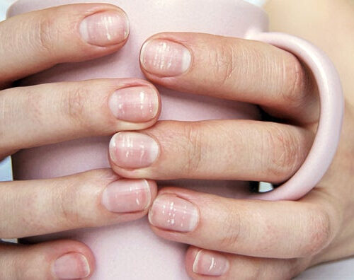 4 Common Nail Changes, and What They Say About Your Health (Plus Nail Health Charts)