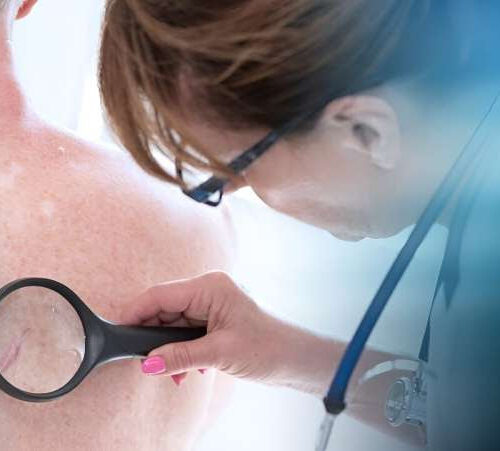 Efficacy shown for new melanoma therapeutic vaccine
