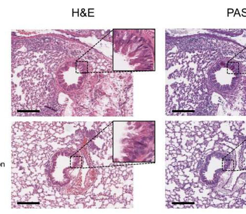 Study reveals new insights on tissue-dependent roles of JAK signaling in inflammation