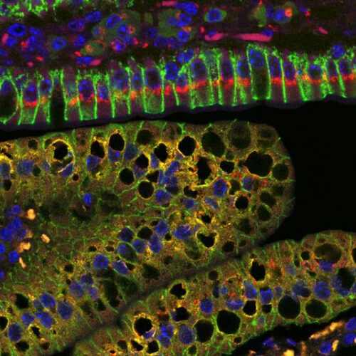 Study unveils a role of mitochondria in dietary fat processing