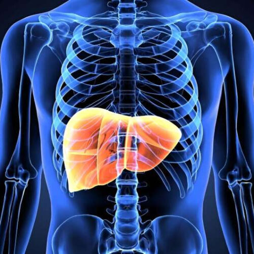 Prevalence of nonalcoholic fatty liver disease set to increase to 34.3% in 2050