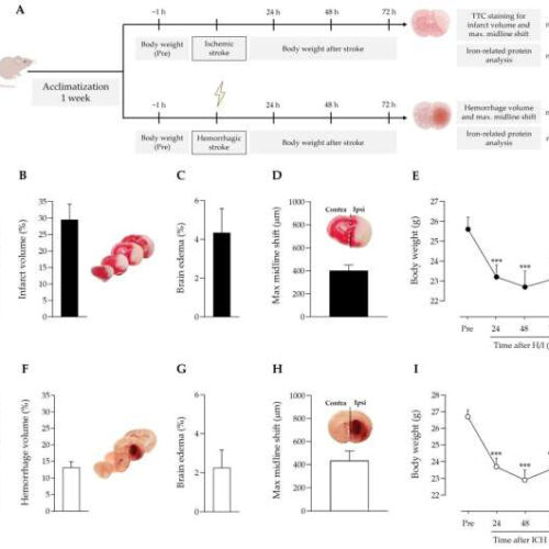 Apotransferrin shows promise as an early treatment for stroke