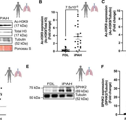 New target identified for pulmonary hypertension treatment