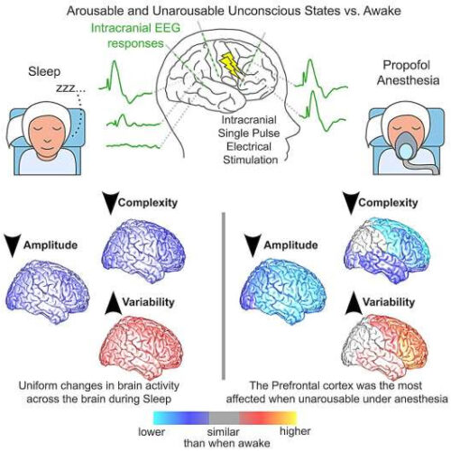 Study unveils the engagement of different cortical networks while humans are unconscious