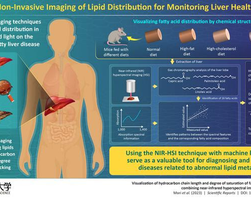 New study unveils machine learning-aided non-invasive imaging for rapid liver fat visualization