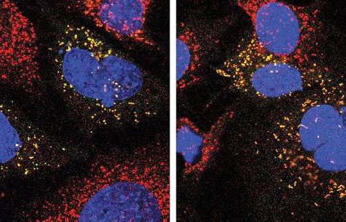 Improved cellular recycling could benefit patients with neurodegenerative conditions