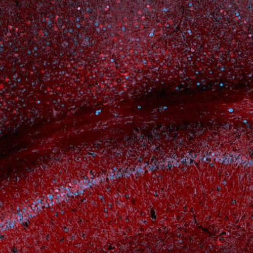 Scientists use blood test to track gene expression in the brain
