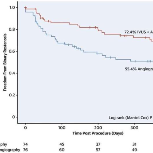 Panel advocates for increased adoption of intravascular ultrasound (IVUS) in peripheral vascular interventions