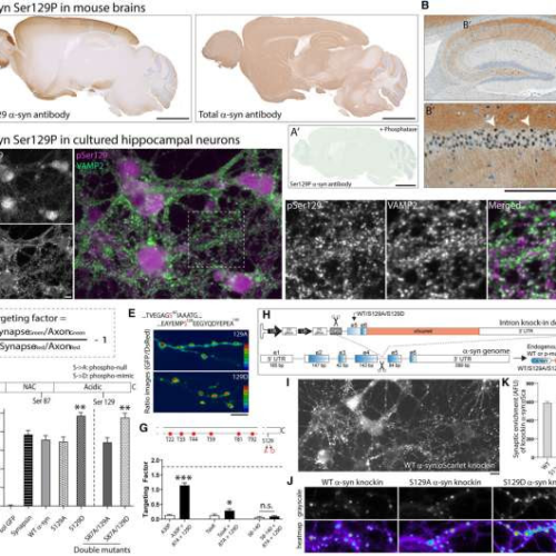 A common marker of neurological diseases may play a role in healthy brains