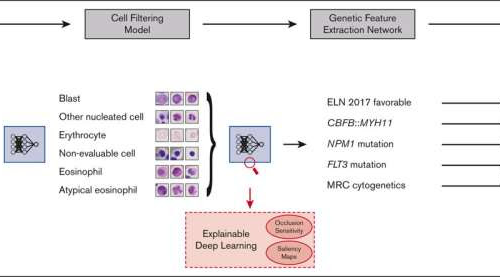 Leukemia: Artificial intelligence provides support in diagnostics