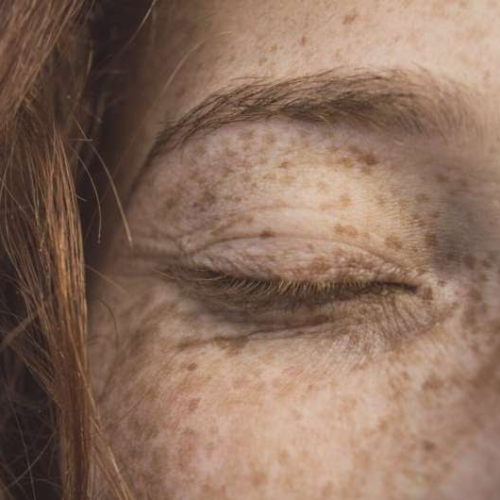New analysis reveals how skin microbiome could be associated with wrinkles and skin health