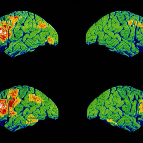 Medical AI falters when assessing patients it hasn’t seen