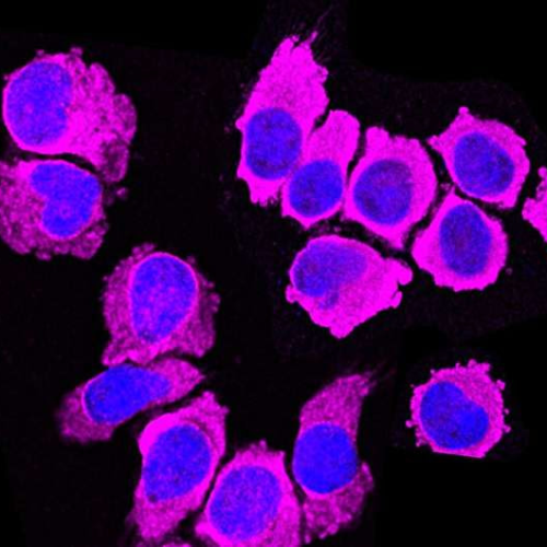 Research reveals an immune cell that can attack cancer