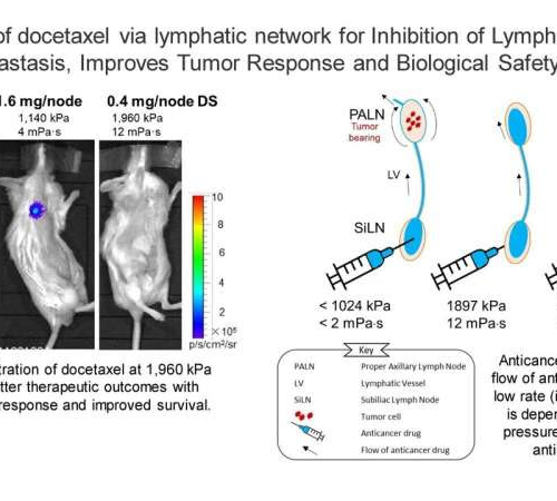 A novel approach for lymph node metastasis treatment