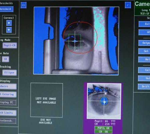 Study provides insights into depression via ophthalmology