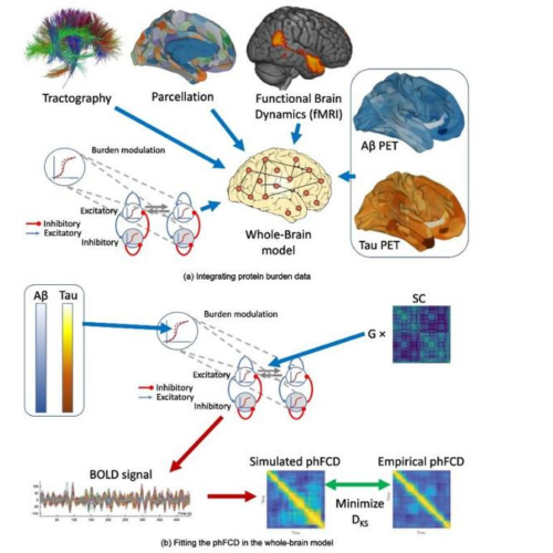 A new neuroscientific study paves the way for improving the diagnosis and treatment of Alzheimer’s