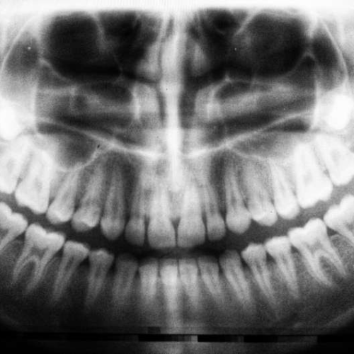 Study mapping entire genome of oral stem cells opens new doors for regenerative medicine