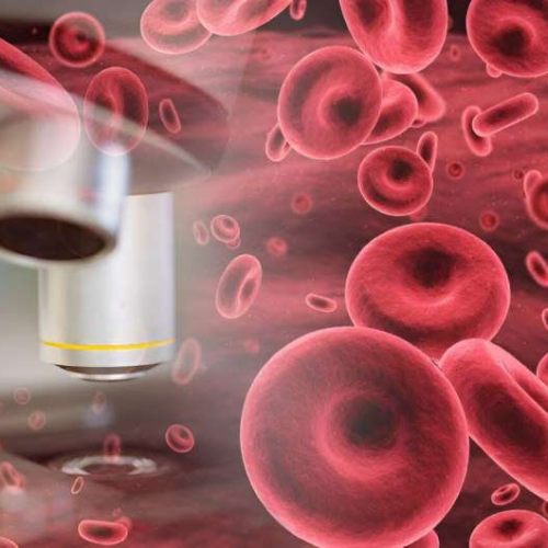 FDA approves exagamglogene autotemcel to treat beta-thalassemia