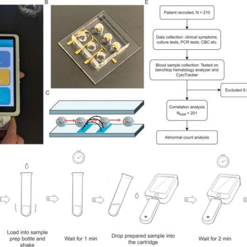 Researchers develop a handheld white blood cell tracker