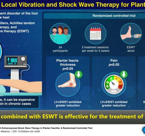 Healing heel pain: Researchers explore the use of local vibration in plantar fasciitis treatment