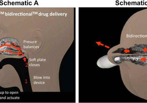 ‘Exhalation’ system improves symptoms for most common form of chronic sinus infections