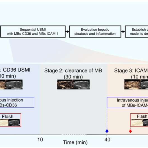 Advancing noninvasive diagnosis of NASH: Potential of sequential ultrasound molecular imaging in NAFLD/MAFLD