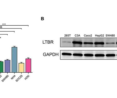 Systematic analysis of the prognostic value and immunological function of LTBR in cancer